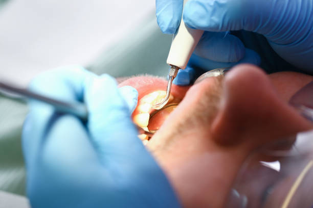 Best Emergency Care for Gum Disease in Seven Points, TX
